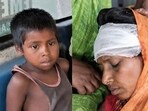 Meena reportedly suffered injuries to her hands, legs, back, and head during the struggle, while Mohit escaped with scratches and minor injuries.