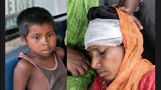 Meena reportedly suffered injuries to her hands, legs, back, and head during the struggle, while Mohit escaped with scratches and minor injuries.