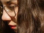 Greasy flakes on nose and scalp can be checked with proper treatment. 