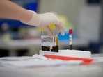 Blood tests do not always detect early stage health issues.