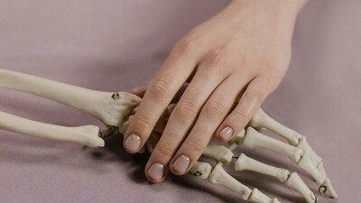Bone loss in women can begin much earlier than expected. (Pexel) Bone loss in women can begin much earlier than expected. (Pexel)