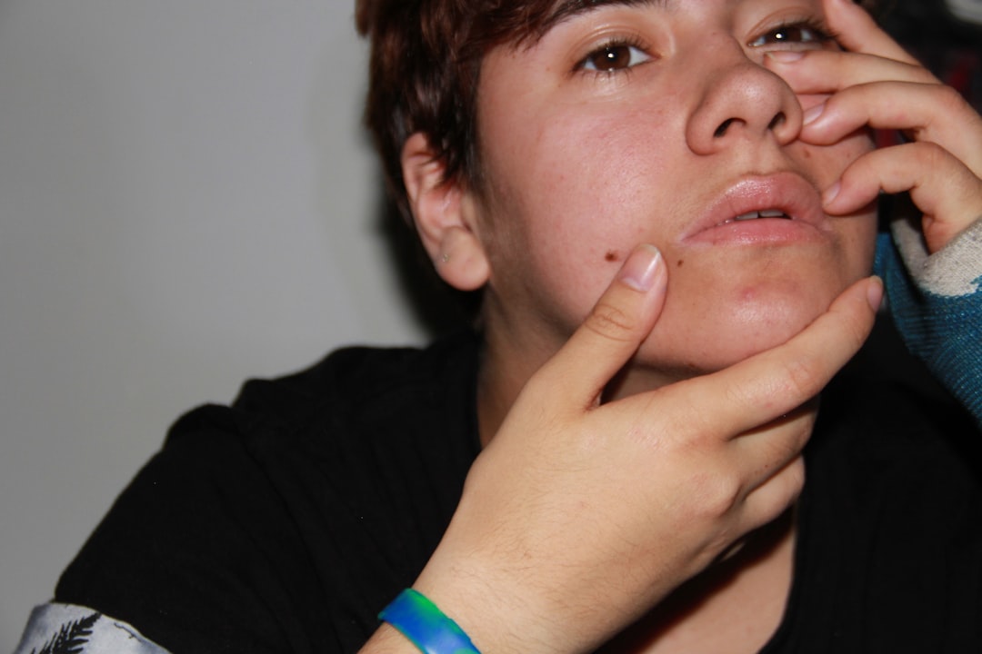 Excessive skincare can trigger breakouts. (Unsplash) Excessive skincare can trigger breakouts. (Unsplash)