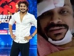 యాక్సిడెంట్ తర్వాత పండు మాస్టర్ వీడియో.. అసలు ఏం జరిగిందో చెప్పిన కొరియోగ్రాఫర్(x)