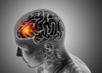 Neurologists explain how to spot brain tumour symptoms early.