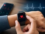 ECG makes a smartwatch far more useful than a simple fitness tracker.