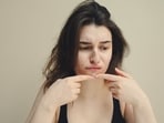 Moisturiser for acne prone skin(Pexels)
