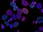  Cancers often develop resistance to targeted drugs such as daraxonrasib. Instead, its promise for patients is that, when used alongside other treatments, it might buy them months more life. (Unsplash)