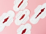 The causes and warning signs of heavy bleeding during periods.