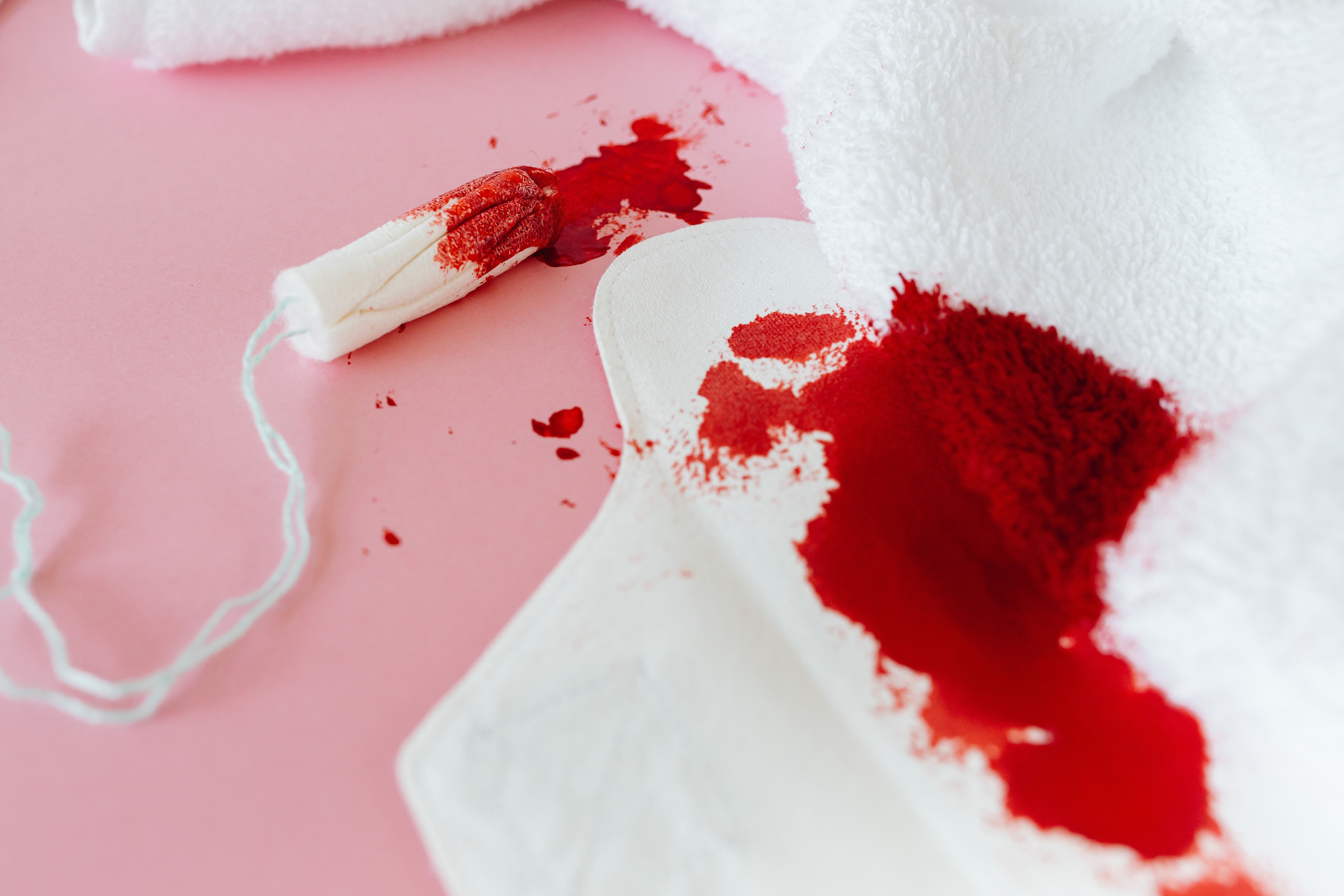 PCOS can cause irregular ovulation, prolonged periods, and excessive menstrual bleeding. (Pexel) PCOS can cause irregular ovulation, prolonged periods, and excessive menstrual bleeding. (Pexel)