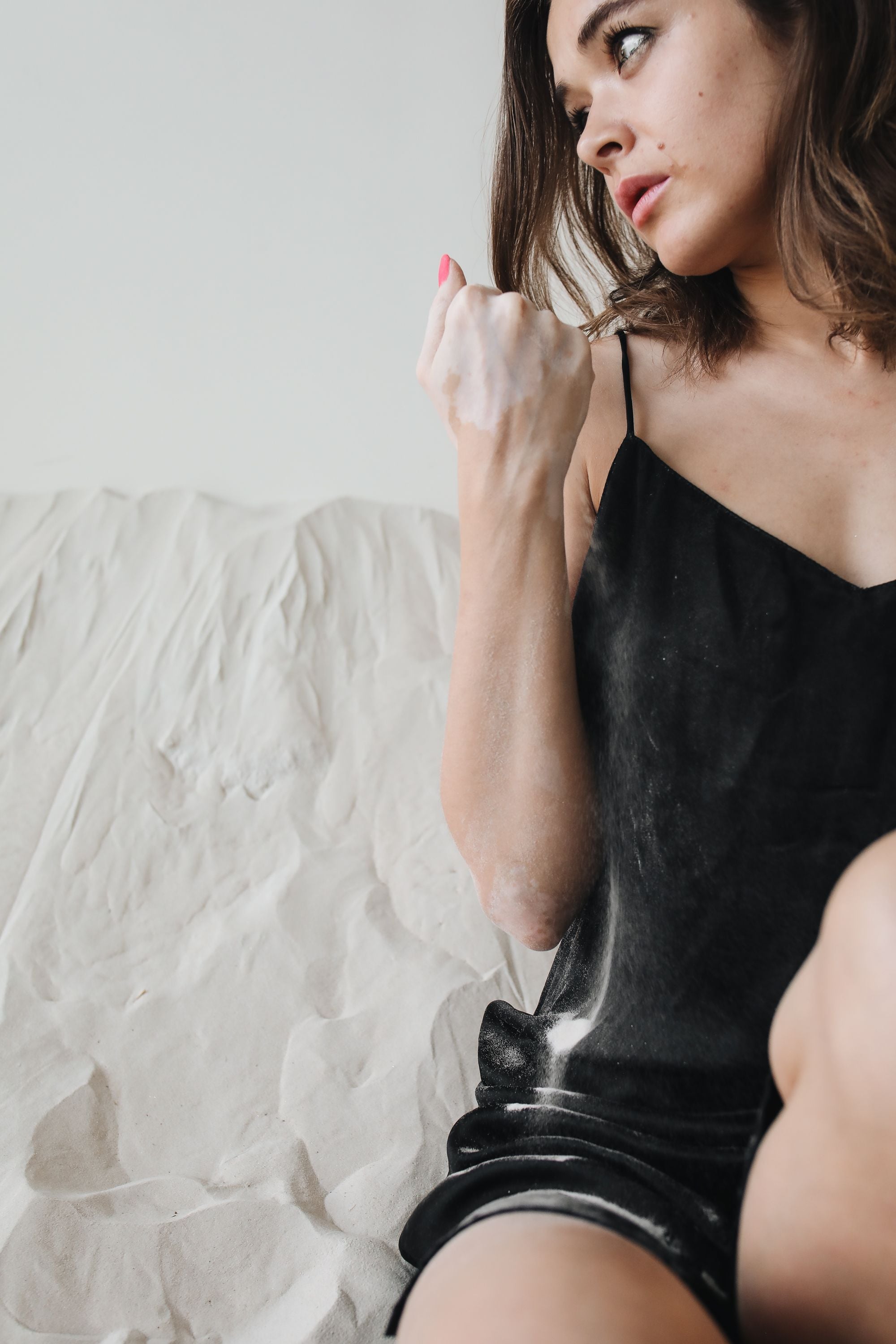 There is a wide myth that vitiligo is triggered by diets, infections or unhygienic conditions. (Pexel) There is a wide myth that vitiligo is triggered by diets, infections or unhygienic conditions. (Pexel)