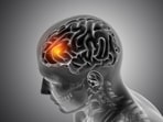 Find out how sugar consumption impacts brain tumours. (Picture credit: Freepik)