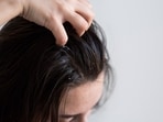 Tips on how to treat itchy and sweaty scalp(magnific)