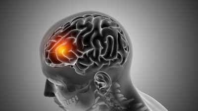 Find out how sugar consumption impacts brain tumours. (Picture credit: Freepik) Find out how sugar consumption impacts brain tumours. (Picture credit: Freepik)