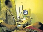 A woman getting her sonography done at Beed city, Beed district, India, on Thursday, June 7, 2012. Photo by- Vidya Subramanian (Hindustan Times)