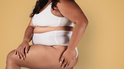 Cellulite is not a "flaw" to be fixed! (Pexel) Cellulite is not a "flaw" to be fixed! (Pexel)