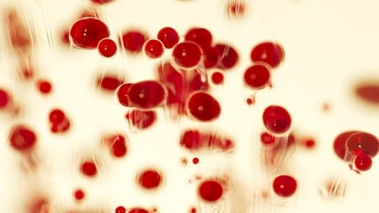 Sickle cell anaemia (Freepik)