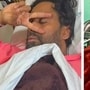 হাসপাতালে ভর্তি কোরিওগ্রাফার বস্কো
