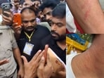 In a post on X, Dipke claimed the two students were attacked while trying to set up a library to encourage people at the protest site to read books.