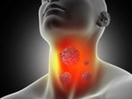 Dr Kartik Krishnan says thyroid cancer is highly treatable and shares the signs you need to know — from voice changes to neck lumps. (Freepik)