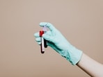 Read more to find out how men can assess their overall health through blood tests.