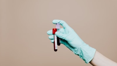 Read more to find out how men can assess their overall health through blood tests. (Pexel) Read more to find out how men can assess their overall health through blood tests. (Pexel)