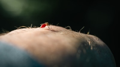 Getting diagnosed early for malaria helps one avoid later complications. (Pexel) Getting diagnosed early for malaria helps one avoid later complications. (Pexel)