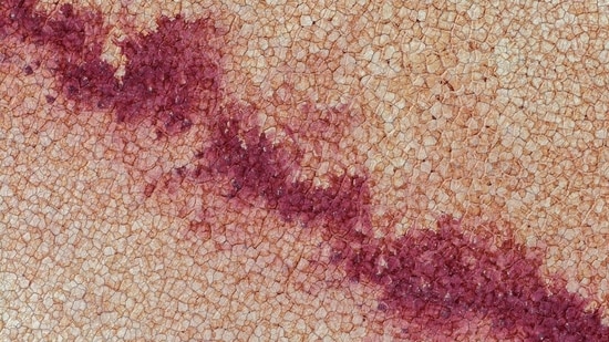 The CDC reports 145 cyclosporiasis cases across 17 states as of June 16, with 20 hospitalizations and no fatalities. The outbreak reflects a seasonal increase, particularly in Michigan, which has seen over 170 cases since June 22. (Pixabay)