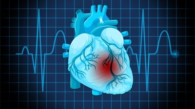 Dr Bhojraj emphasises that heart disease can progress silently, urging proactive preventive care. (Freepik) Dr Bhojraj emphasises that heart disease can progress silently, urging proactive preventive care. (Freepik)