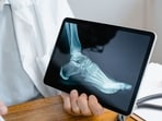Early warning signs of bone cancer you shouldn't ignore.