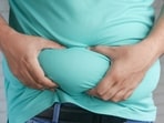 Obesity can exert stress and make your heart overwork and age faster. 