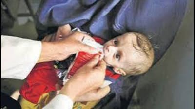 Along with underweight, the prevalence of malnourished children under the age of five has also increased, shows the data of national family health survey 2023-24. Along with underweight, the prevalence of malnourished children under the age of five has also increased, shows the data of national family health survey 2023-24.