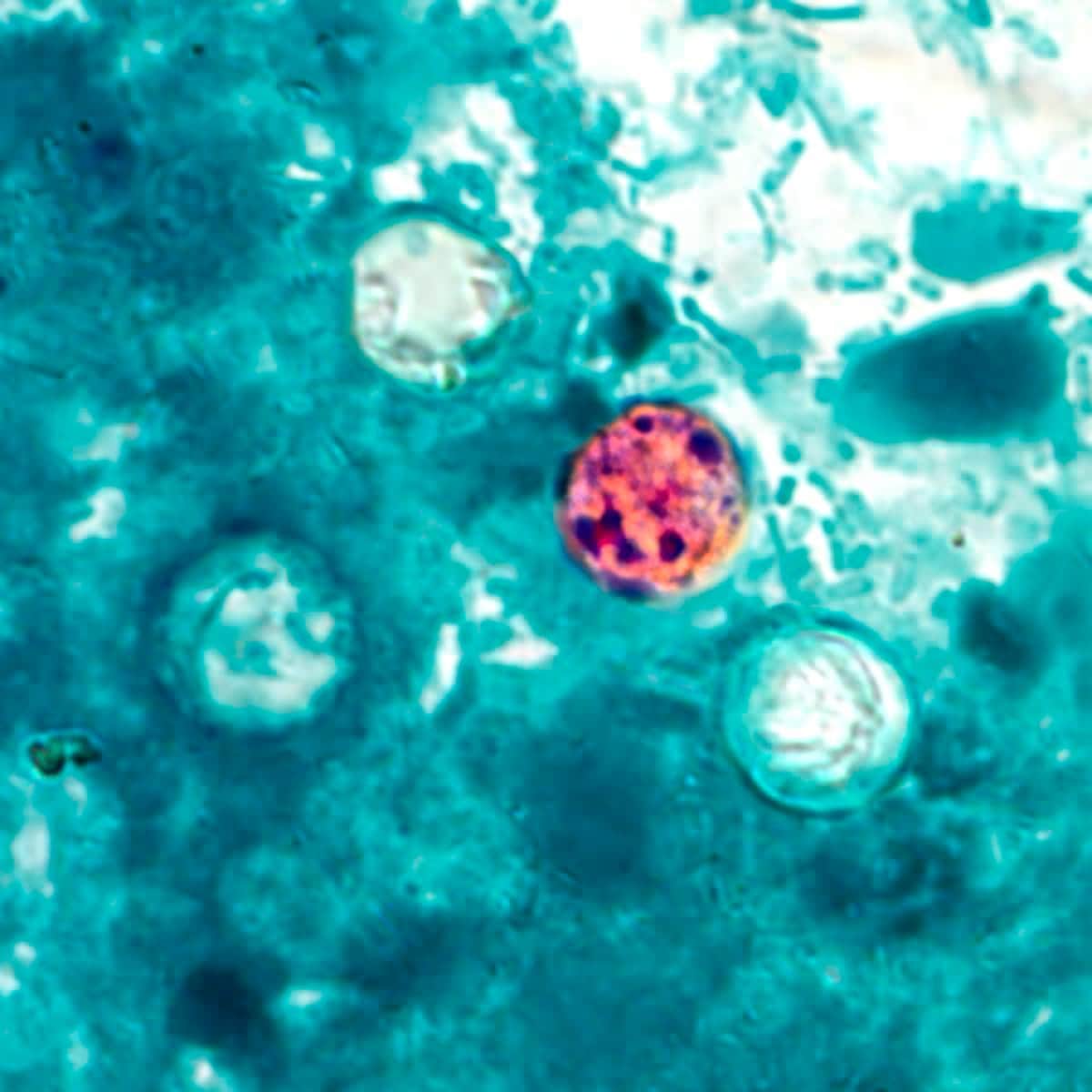 Four cyclospora oocysts visible in an enlarged image of a stool sample. Four cyclospora oocysts visible in an enlarged image of a stool sample.
