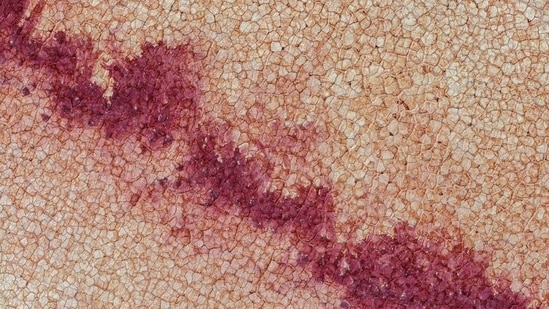 Cyclosporiasis cases are rising across the US. (Pixabay/Representative)(Pixabay)