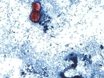 This undated photo taken through a microscope provided by the CDC shows Cyclospora cayetanensis oocysts found in a fresh stool sample which had been prepared with a formalin solution and stained with safranin.