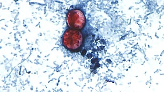 Microscopic image provided by the CDC shows cyclospora cayetanensis oocysts found in a stool sample, which had been prepared with a formalin solution and stained with safranin.