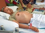 Medical staff check on environmentalist Sonam Wangchuk on the 18th day of his indefinite hunger strike as part of the Cockroach Janata Party's (CJP) protest.