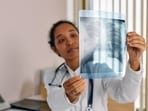 People who have asthma, obstructive pulmonary disease or allergic rhinitis are more likely to get fungal lung infections.