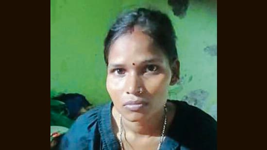 Domestic help suffers severe bite wounds, referred to GMCH in sec-32. (HT PHOTO)