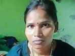 Domestic help suffers severe bite wounds, referred to GMCH in sec-32. (HT PHOTO)