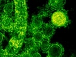 A third fatality from Legionnaires' disease has been confirmed in NYC, with 74 cases reported.