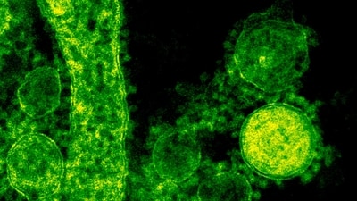A third fatality from Legionnaires' disease has been confirmed in NYC, with 74 cases reported. (Pexel) A third fatality from Legionnaires' disease has been confirmed in NYC, with 74 cases reported. (Pexel)