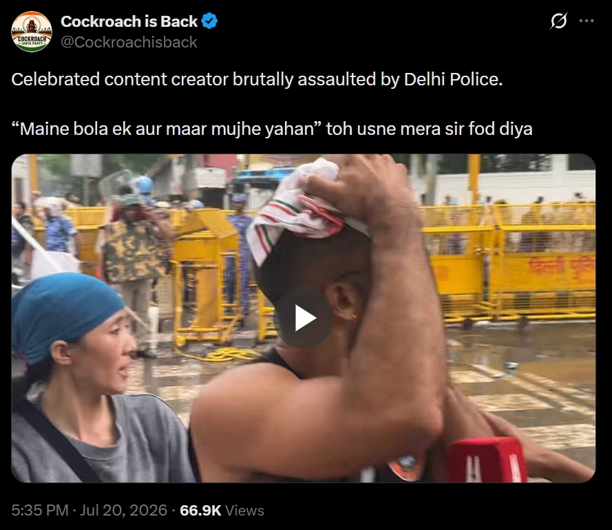 Ramit Verma also known as 'Peeing Human' was injured in police strikes. (@Cockroachisback/X) Ramit Verma also known as 'Peeing Human' was injured in police strikes. (@Cockroachisback/X)