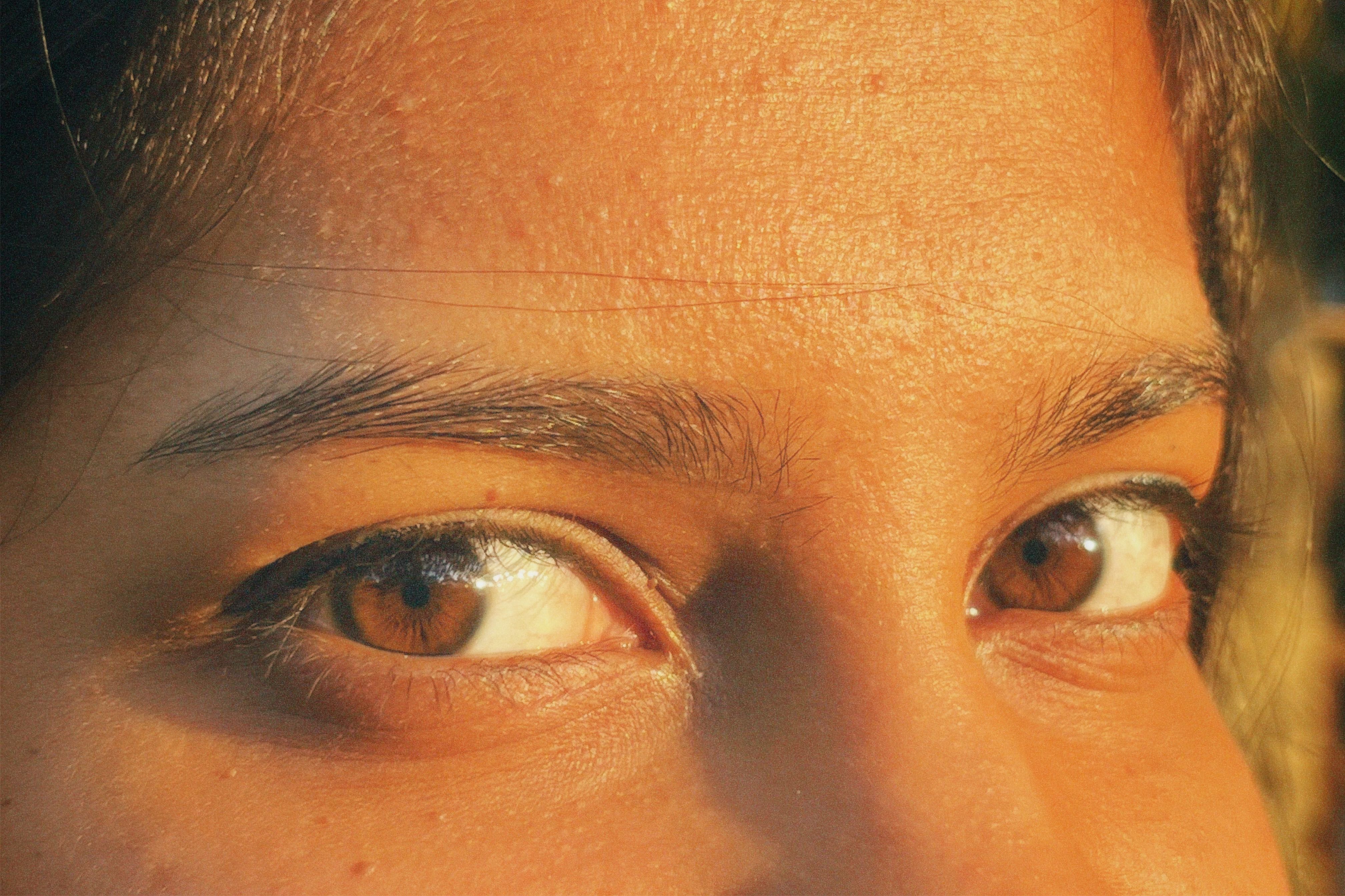 Women are more prone to the dry eye condition. (Pexel) Women are more prone to the dry eye condition. (Pexel)