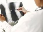 Early diagnosis improves the chances of effective treatment of bone cancer.