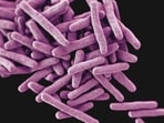 Bacillus cereus is commonly found in foods such as rice, pasta, potatoes, sauces, dairy products and fish.