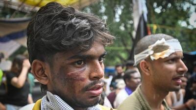 Injured protesters seen at Jantar Mantar, a day after clashes erupted during the Parliament March protest. (Sanchit Khanna/HT Photo) Injured protesters seen at Jantar Mantar, a day after clashes erupted during the Parliament March protest. (Sanchit Khanna/HT Photo)
