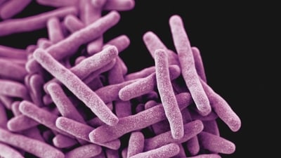 Bacillus cereus is commonly found in foods such as rice, pasta, potatoes, sauces, dairy products and fish. (Unsplash/ Representational)