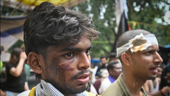 Injured protesters seen at Jantar Mantar, a day after clashes erupted during the Parliament March protest. (Sanchit Khanna/HT Photo)