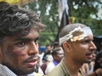 Injured protesters seen at Jantar Mantar, a day after clashes erupted during the Parliament March protest. (Sanchit Khanna/HT Photo)