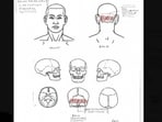 Nolan Wells autopsy: Chief Medical Examiner Dr. Roger Mitchell held a press conference at the NAACP National Convention to share preliminary findings from an independent autopsy into the death of 18-year-old Nolan Wells.